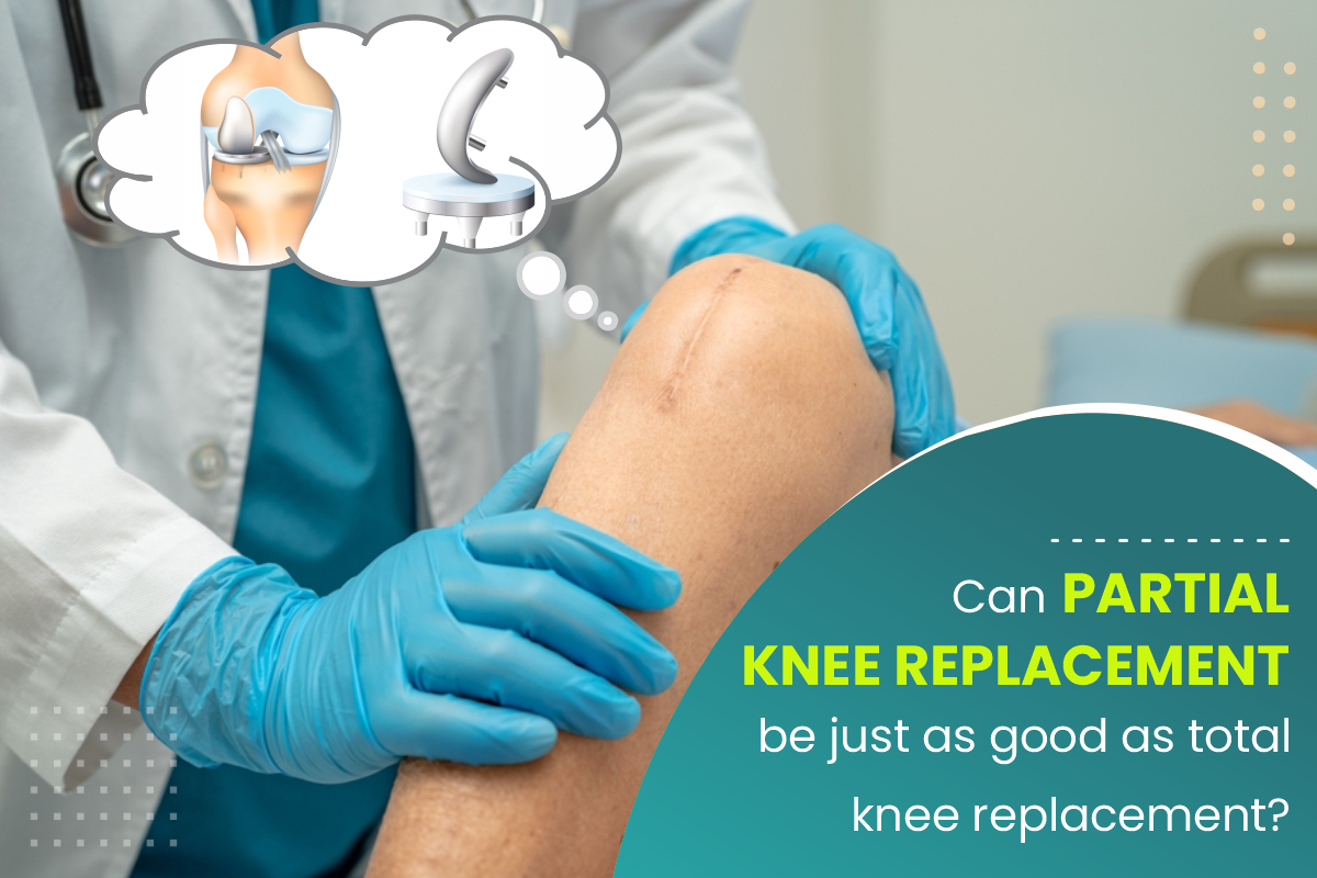 Can partial knee replacement be just as good as total Knee replacement?