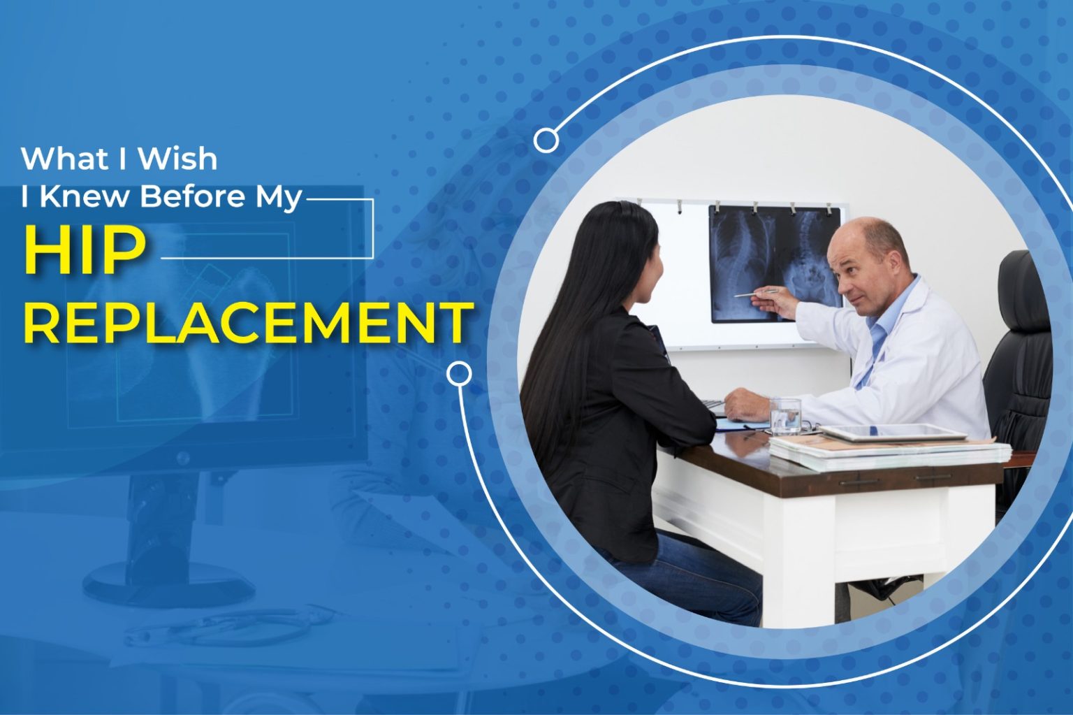 What I Wish I Knew Before My Hip Replacement